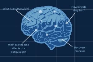 The impact of concussions